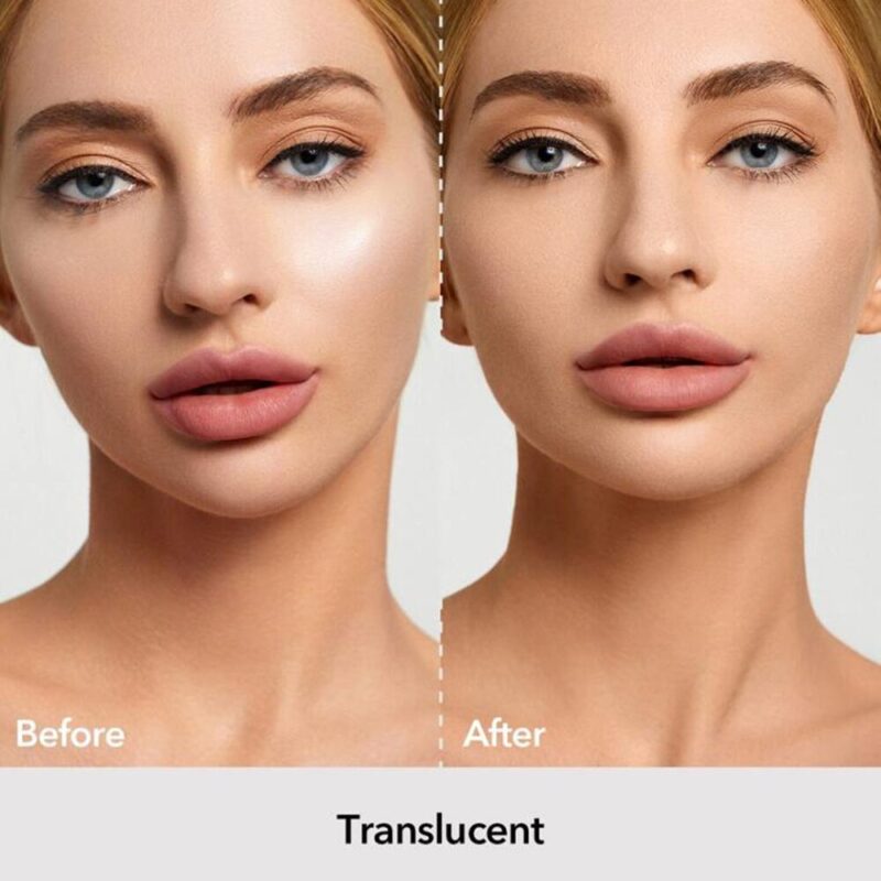 ⁦لوس بودر شيجلام⁩ - الصورة ⁦8⁩